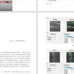 391【新华学院】基于MATLAB的齿轮缺陷检测算法研究-锤锤工作室