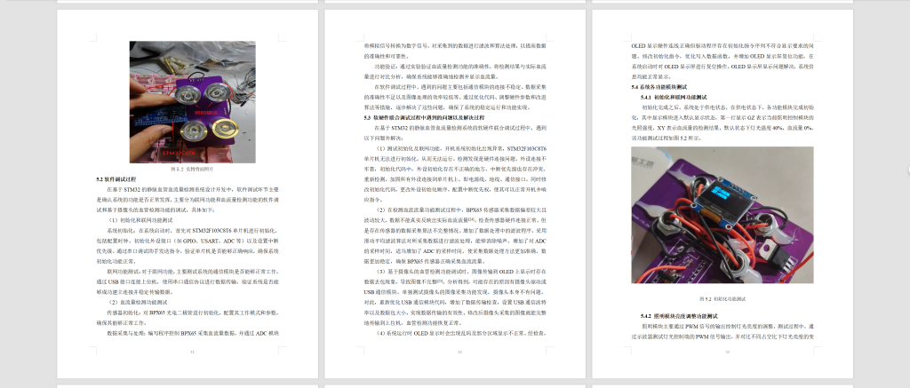 图片[12]-794基于STM32的静脉血管血流量检测系统设计【论文+实物设计资料】-锤锤工作室